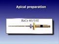 root canal treatment clinical case part 2 using race files root canal treatment clinical case part 2 using race files
