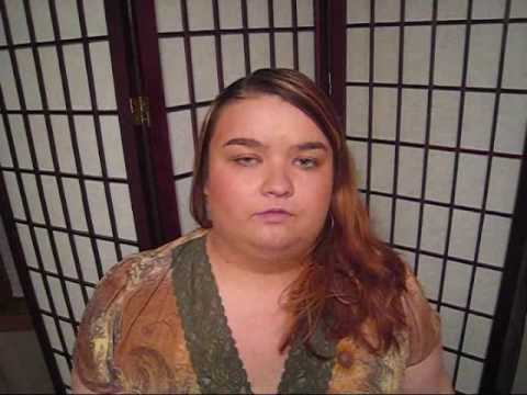 One week LapBand post-op One week LapBand post-op