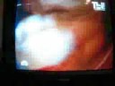 YouTube - VITAS plateaus YouTube - VITAS plateaus