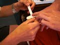 Finger Splint Buddy Tap Finger Splint Buddy Tap