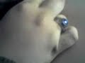 amputation of a back nipple(holy moley)