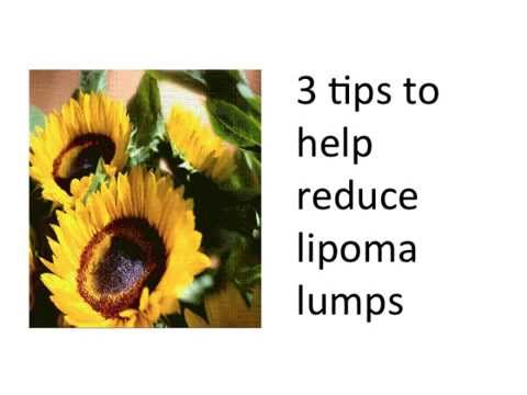 how to dissolve lipomas