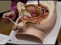 Male reproductive