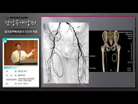 [국민건강보험 일산병원 건강강좌]말초동맥폐쇄증의 진단