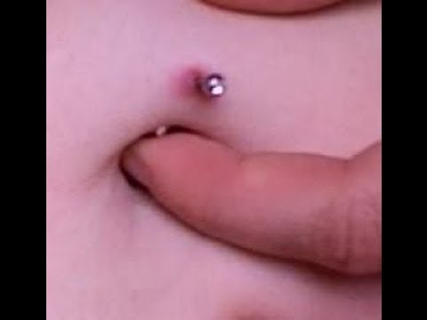 how to treat nipple piercing infection