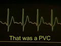 MY HEARTBEAT MY HEARTBEAT
