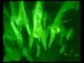 The residents - Where is she The residents - Where is she