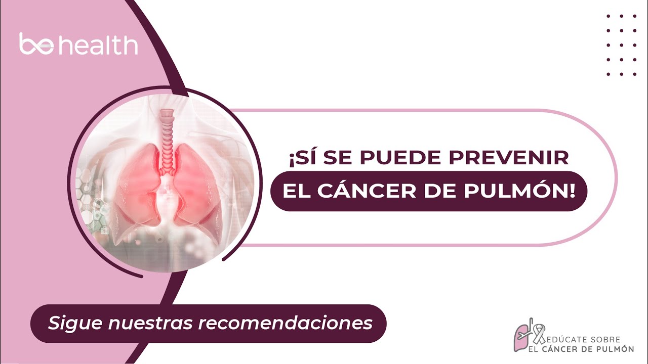 ¿Se puede prevenir el CÁNCER DE PULMÓN?