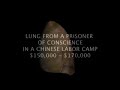 Organ Harvesting Public Service Announcement