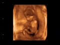Bebe de 15 semanas Bebe de 15 semanas