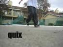 quix vs. SickSense. quix vs. SickSense.