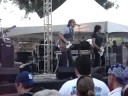 Louis XIV ACL \