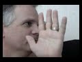 Dr. Russ Rudy Small Finger Injury Dr. Russ Rudy Small Finger Injury