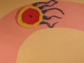 Implantation Animation