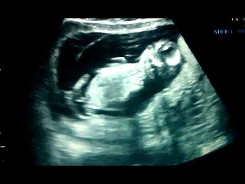 Ultrasound 13 Weeks Boy Confirmed | Belly Videos