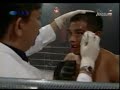 Suratno VS Rudi Santoso