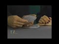 New York Plastic Surgery Transumbilical Breast Augmentation