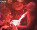 9. Scars Like Medals - Lymphatic Glands Live