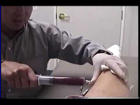 how to drain knee effusion