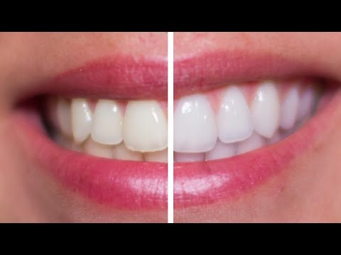 how to whiten blinds
