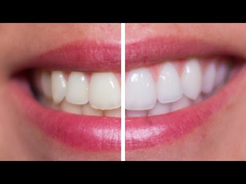 how to whiten human teeth