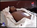 Canal31 - Ni�o muere en sala de operaciones