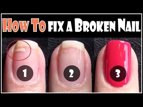 how to repair broken nail