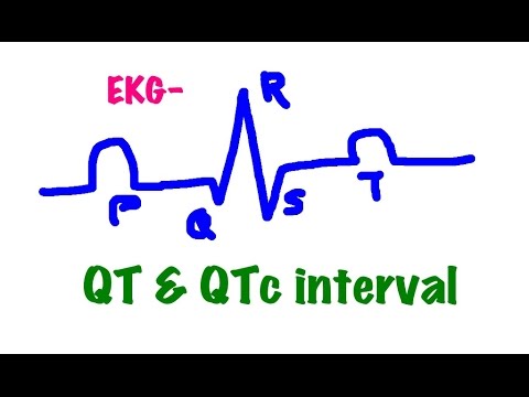 how to calculate qt interval