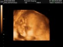 Haylee opening her eyes