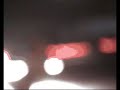 GIHT SHASIE - bradavice, neugodno sme?e boje...