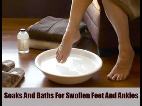 how to cure swollen feet