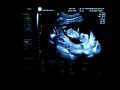 videos de Echo12w4d-2.MOV