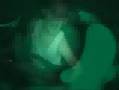 Atria - Think Before ...