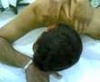 Fisioterapia con dolore 2