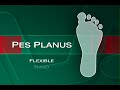 Dr. Craig Lowe discusses the pes cavus (high arch) foot type. 3DO Digital Orthotics offers a full turn key 3D foot scanning and custom orthotic solution for physicians and retailers. Visit us at http://www.digitalorthotics.com for more information on our products and services.