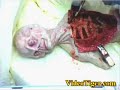 Real Alien Autopsy