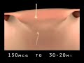 Birth Control Pills Cause Embryonic Abortions Pro-Life Video