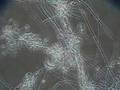 videos de Protozoa & Filamentous Bacteria