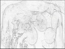 Simulated Thoracic Injection Simulated Thoracic Injection