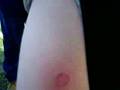 paintball slaghter wounds