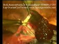 Laparoscopy Twisted Ovarian Cyst Video (Lap Ovary Cyst) Laparoscopy Twisted Ovarian Cyst Video (Lap Ovary Cyst)