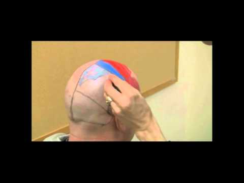 Cerebrum - In this video we describe all the different areas of the cerebrum and their functions.