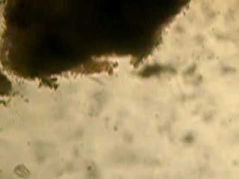 Rotifers from the bird bath