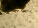 Rotifers from the bird bath