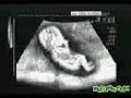 Scan Bayi Yang Asyik Menendang Didalam Kandungan