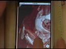 HiDef Medical 3D on iPhone