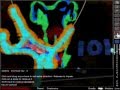 The Torture Game 2 (RADOM STUFF)