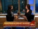 Disappearing Breast Cancer?