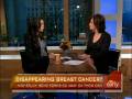 Disappearing-Breast-