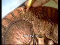 kidney